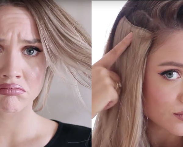 hair loss