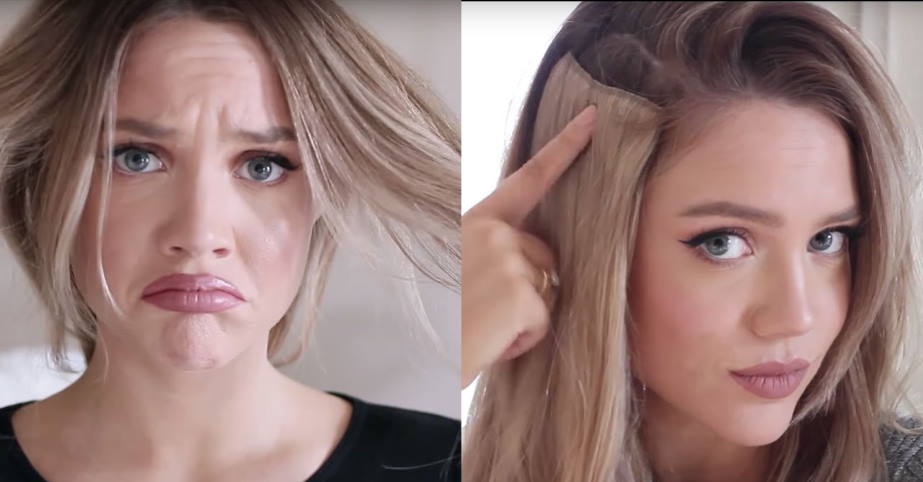 hair loss